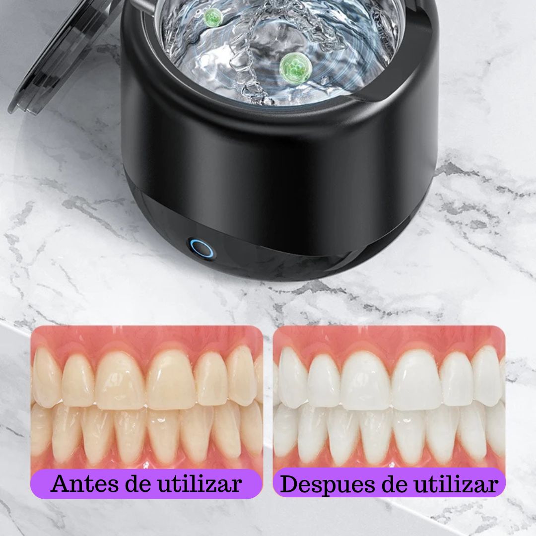 Limpiador ultrasónico para dentaduras postizas y brackets